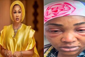 Mercy Aigbe Reveals Painful Battle with Eye Infection During Filming: A Tale of Resilience and Dedication