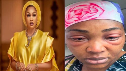 Mercy Aigbe Reveals Painful Battle with Eye Infection During Filming: A Tale of Resilience and Dedication