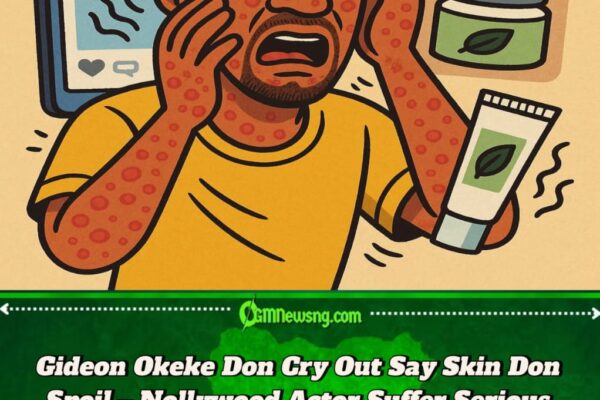 Actor Gideon Okeke Don Shout O! Skin Wahala Dey Worry Am – See Wetin Cause Di Reaction”
