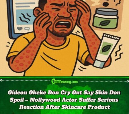 Actor Gideon Okeke Don Shout O! Skin Wahala Dey Worry Am – See Wetin Cause Di Reaction”