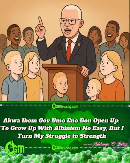 Akwa Ibom Gov Umo Eno Don Open Up: “To Grow Up With Albinism No Easy, But I Turn My Pain to Power