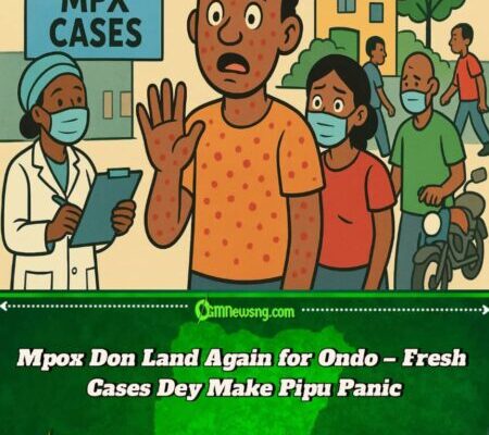 Mpox Don Show Face Again for Ondo – Fresh Cases Scatter Residents’ Mind