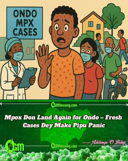 Mpox Don Show Face Again for Ondo – Fresh Cases Scatter Residents’ Mind